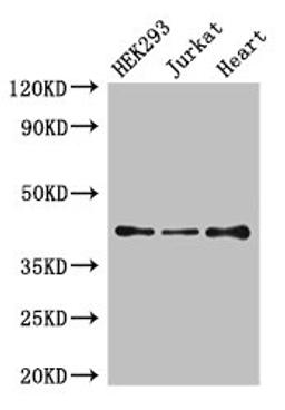 Western Blot. Positive WB detected in: HEK293 whole cell lysate, Jurkat whole cell lysate, Mouse heart tissue. All lanes: S1PR5 antibody at 4µg/ml. Secondary. Goat polyclonal to rabbit IgG at 1/50000 dilution. Predicted band size: 42, 33 kDa. Observed band size: 42 kDa