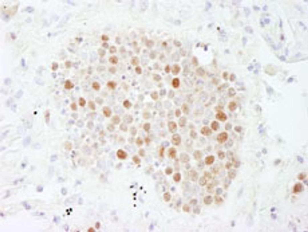 Detection of human CAF-1 p60 by immunohistochemistry.