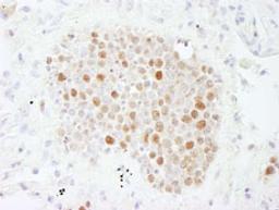 Detection of human CAF-1 p60 by immunohistochemistry.