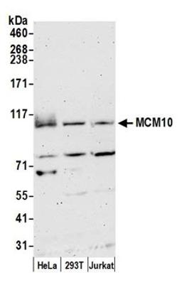 Detection of human MCM10 by western blot.