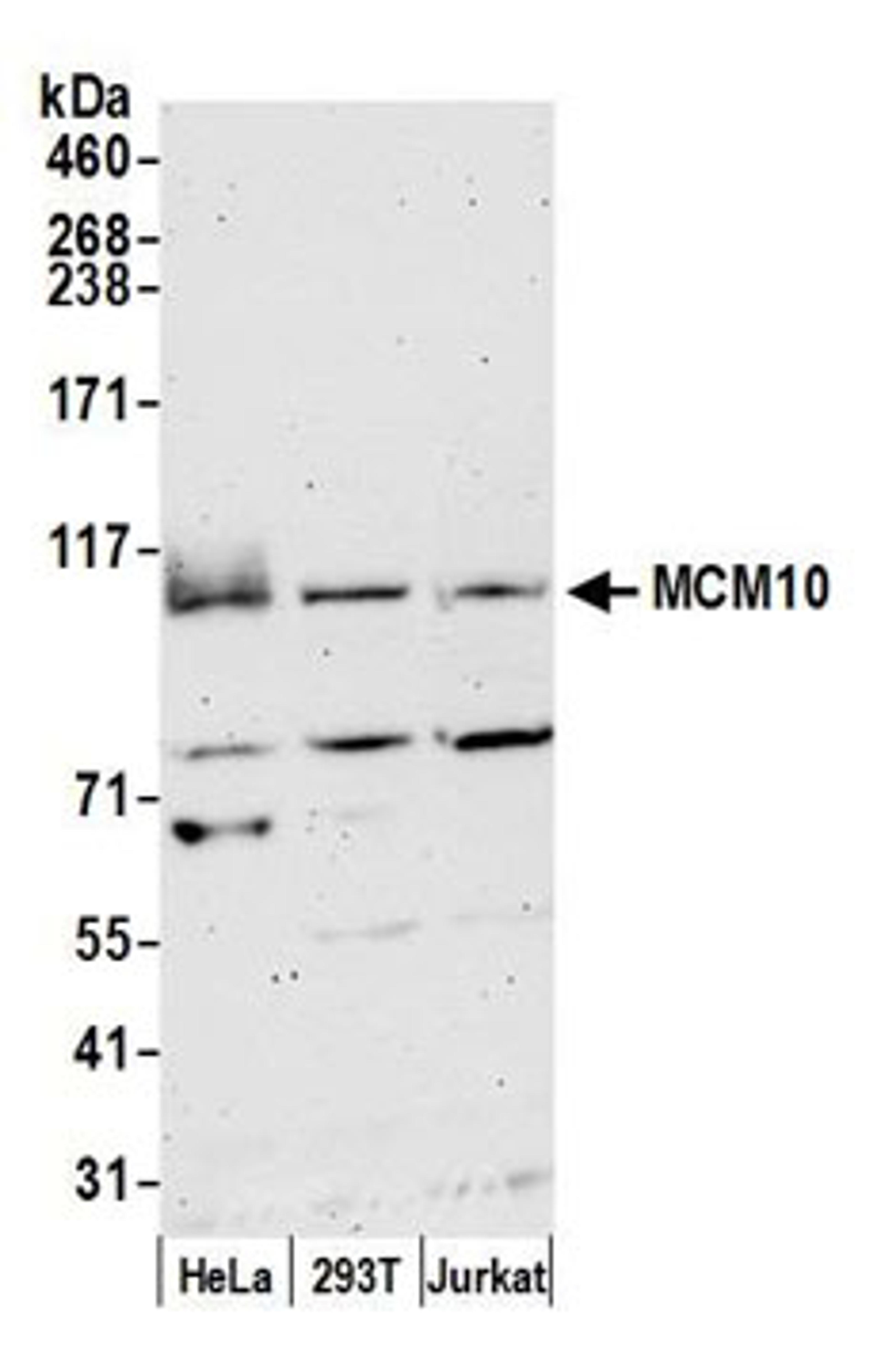 Detection of human MCM10 by western blot.