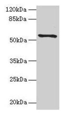 Western blot. All lanes: TMEM161A antibody at 1µg/ml + PC-3 whole cell lysate. Secondary. Goat polyclonal to rabbit IgG at 1/10000 dilution. Predicted band size: 54, 42 kDa. Observed band size: 54 kDa