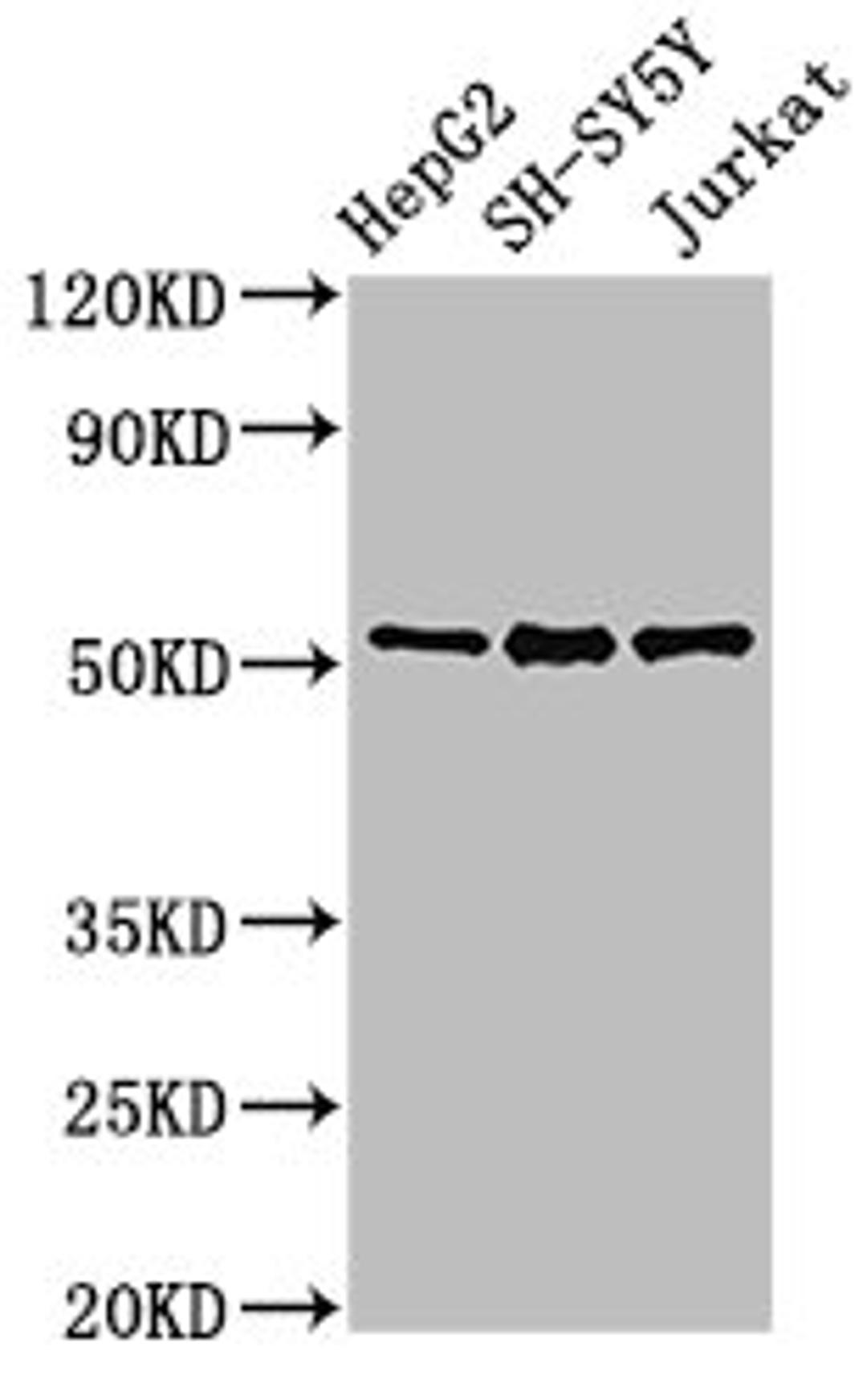 Western Blot. Positive WB detected in: HepG2 whole cell lysate, SH-SY5Y whole cell lysate, Jurkat whole cell lysate. All lanes: PRKN antibody at 3µg/ml. Secondary. Goat polyclonal to rabbit IgG at 1/50000 dilution. Predicted band size: 52, 49, 24, 31, 43, 36, 44, 47 kDa. Observed band size: 52 kDa