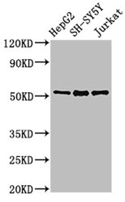 Western Blot. Positive WB detected in: HepG2 whole cell lysate, SH-SY5Y whole cell lysate, Jurkat whole cell lysate. All lanes: PRKN antibody at 3µg/ml. Secondary. Goat polyclonal to rabbit IgG at 1/50000 dilution. Predicted band size: 52, 49, 24, 31, 43, 36, 44, 47 kDa. Observed band size: 52 kDa