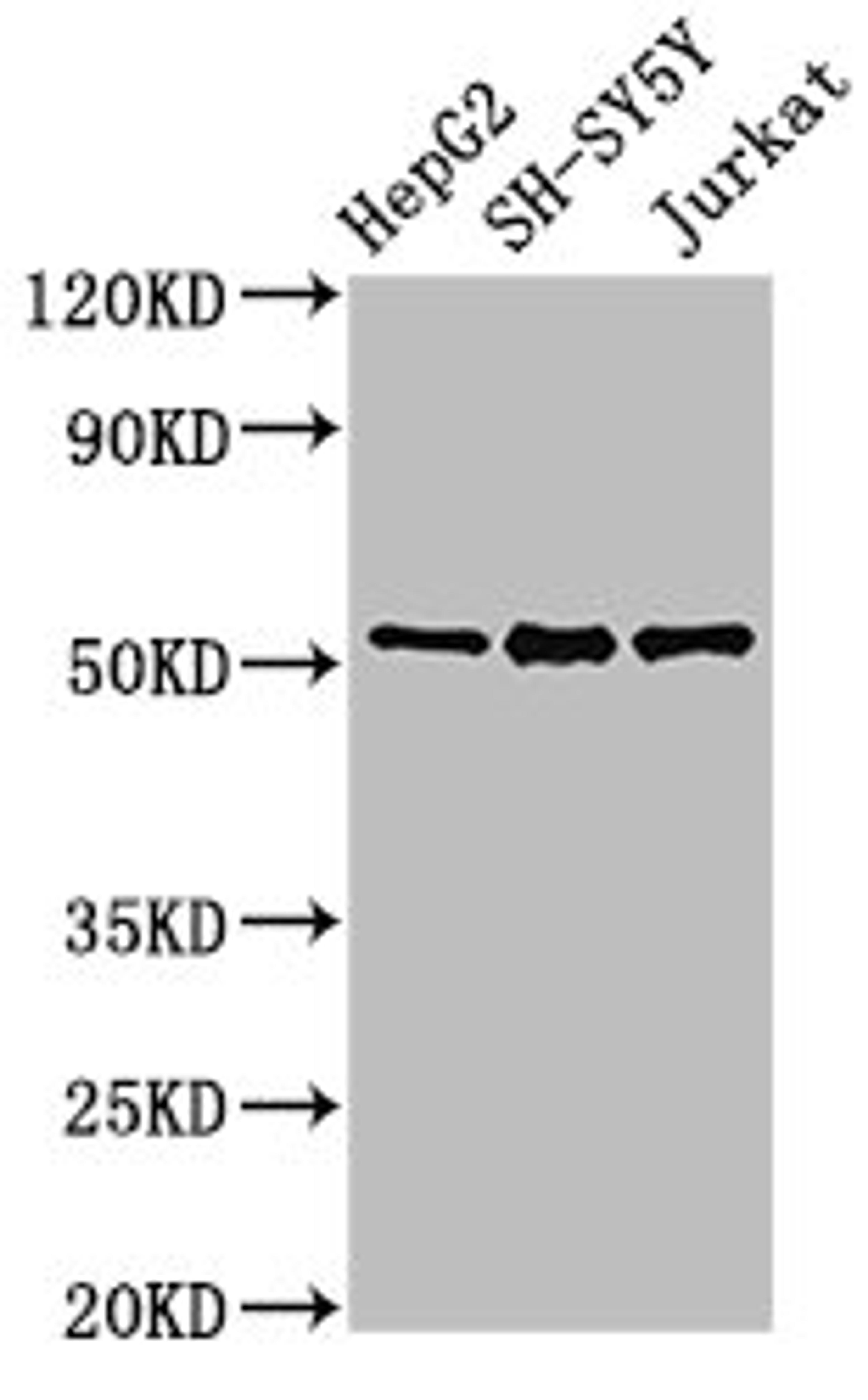 Western Blot. Positive WB detected in: HepG2 whole cell lysate, SH-SY5Y whole cell lysate, Jurkat whole cell lysate. All lanes: PRKN antibody at 3µg/ml. Secondary. Goat polyclonal to rabbit IgG at 1/50000 dilution. Predicted band size: 52, 49, 24, 31, 43, 36, 44, 47 kDa. Observed band size: 52 kDa