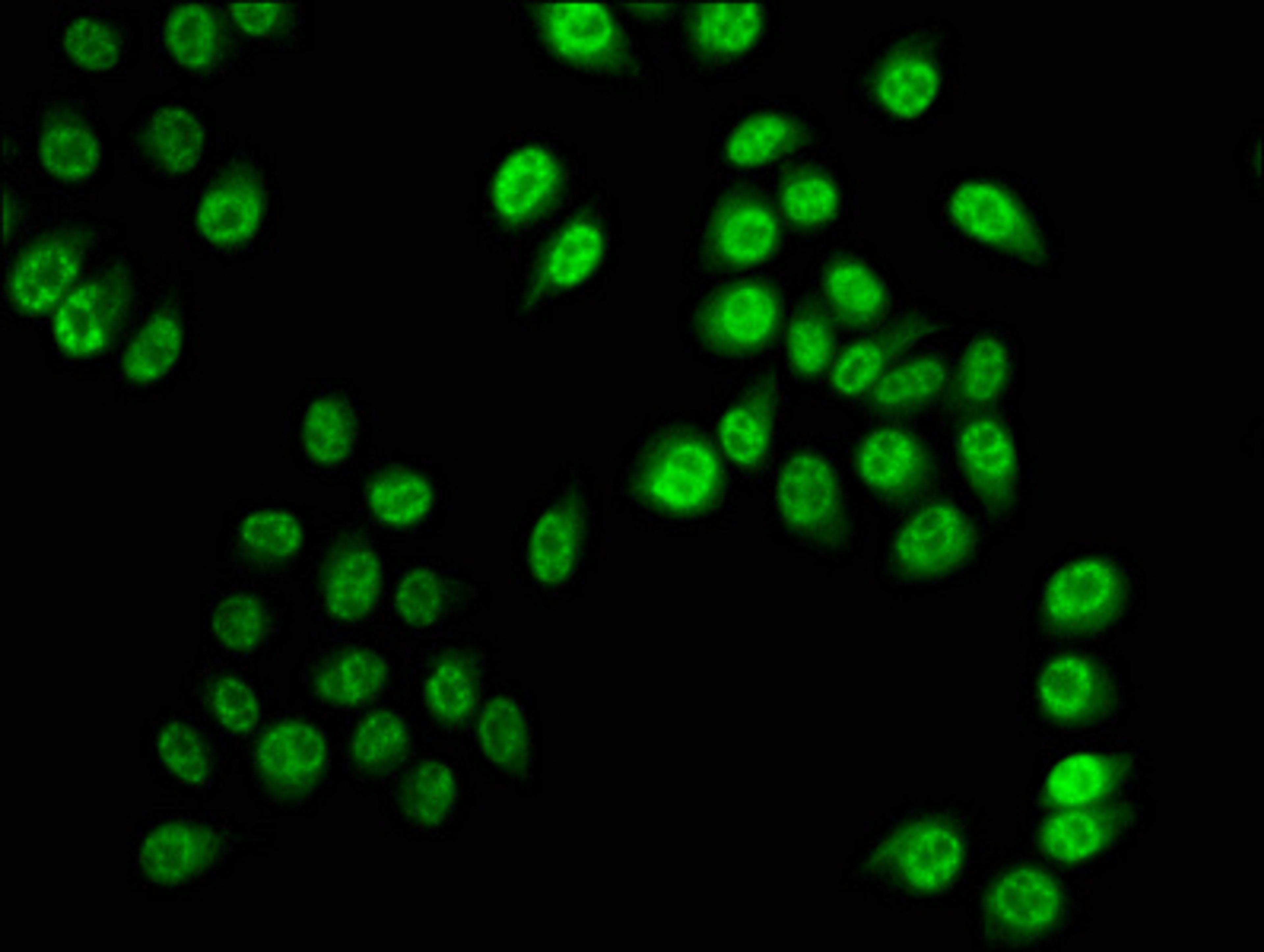 Immunofluorescence staining of Hela cells with CSB-PA010418OA28phHU at 1:5, counter-stained with DAPI. The cells were fixed in 4% formaldehyde, permeabilized using 0.2% Triton X-100 and blocked in 10% normal Goat Serum. The cells were then incubated with the antibody overnight at 4°C. The secondary antibody was Alexa Fluor 488-congugated AffiniPure Goat Anti-Rabbit IgG(H+L).