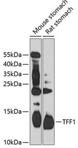 Western blot - TFF1 antibody (A13358)