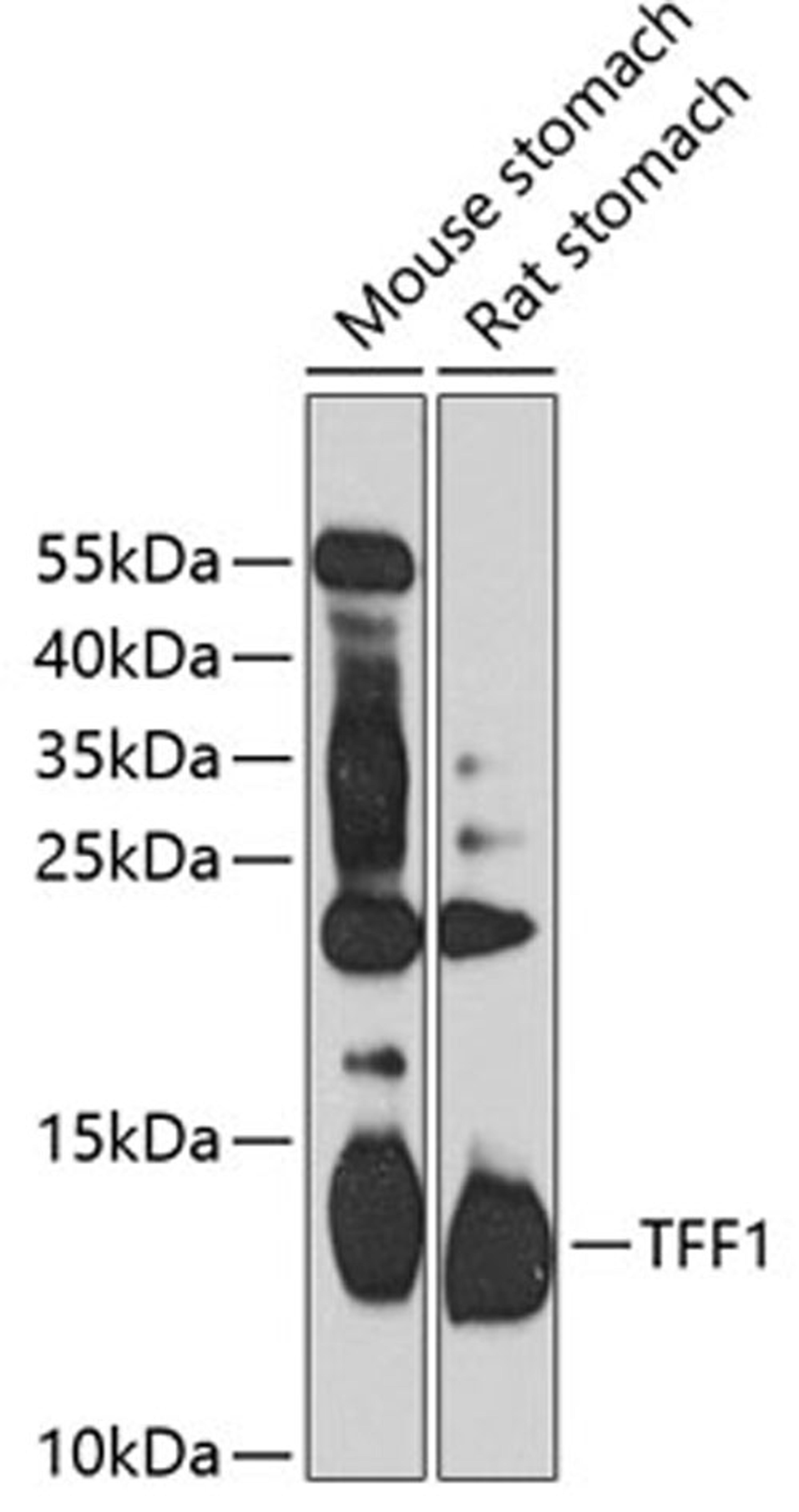 Western blot - TFF1 antibody (A13358)