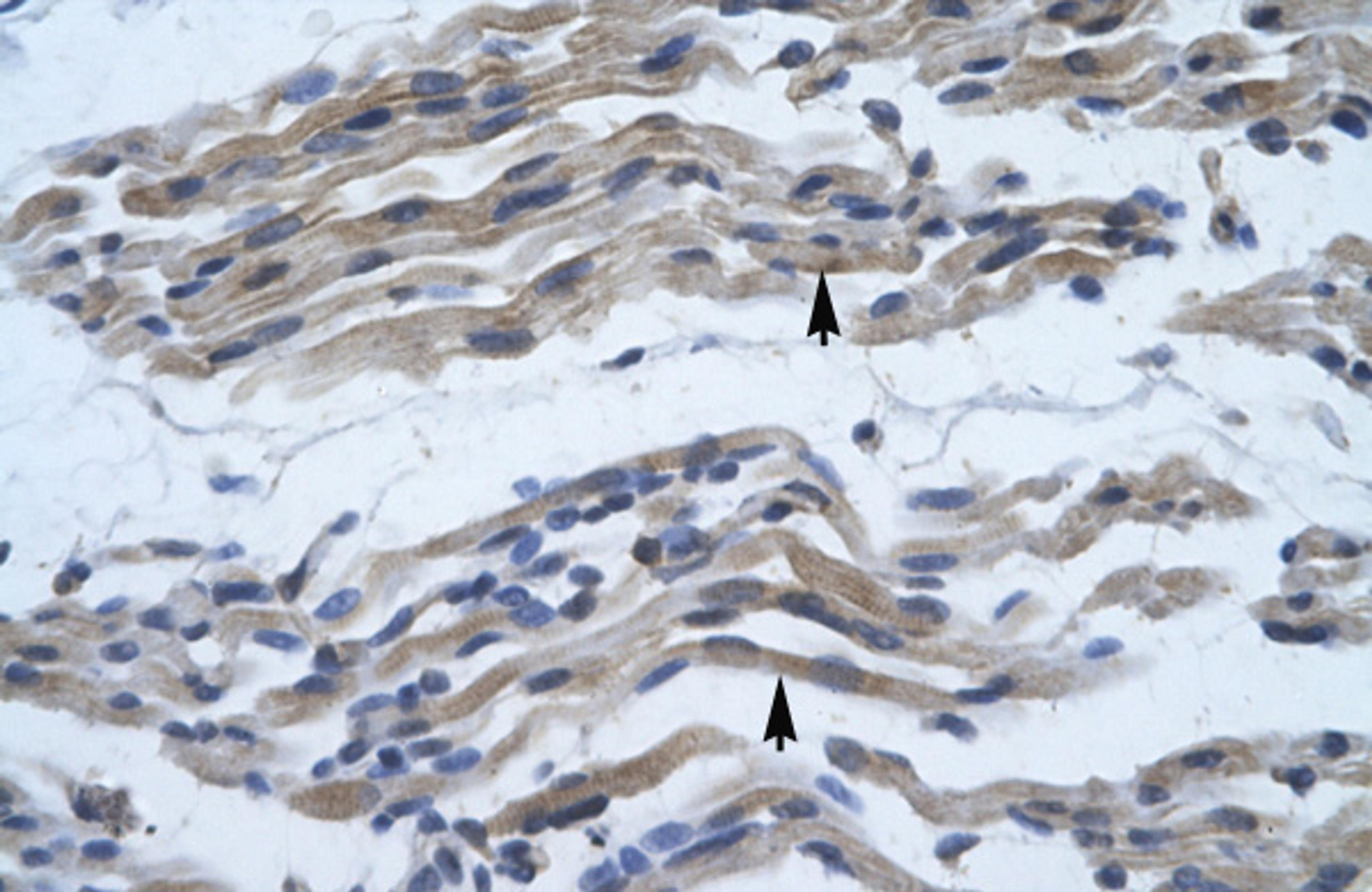 Antibody used in IHC on Human Muscle.