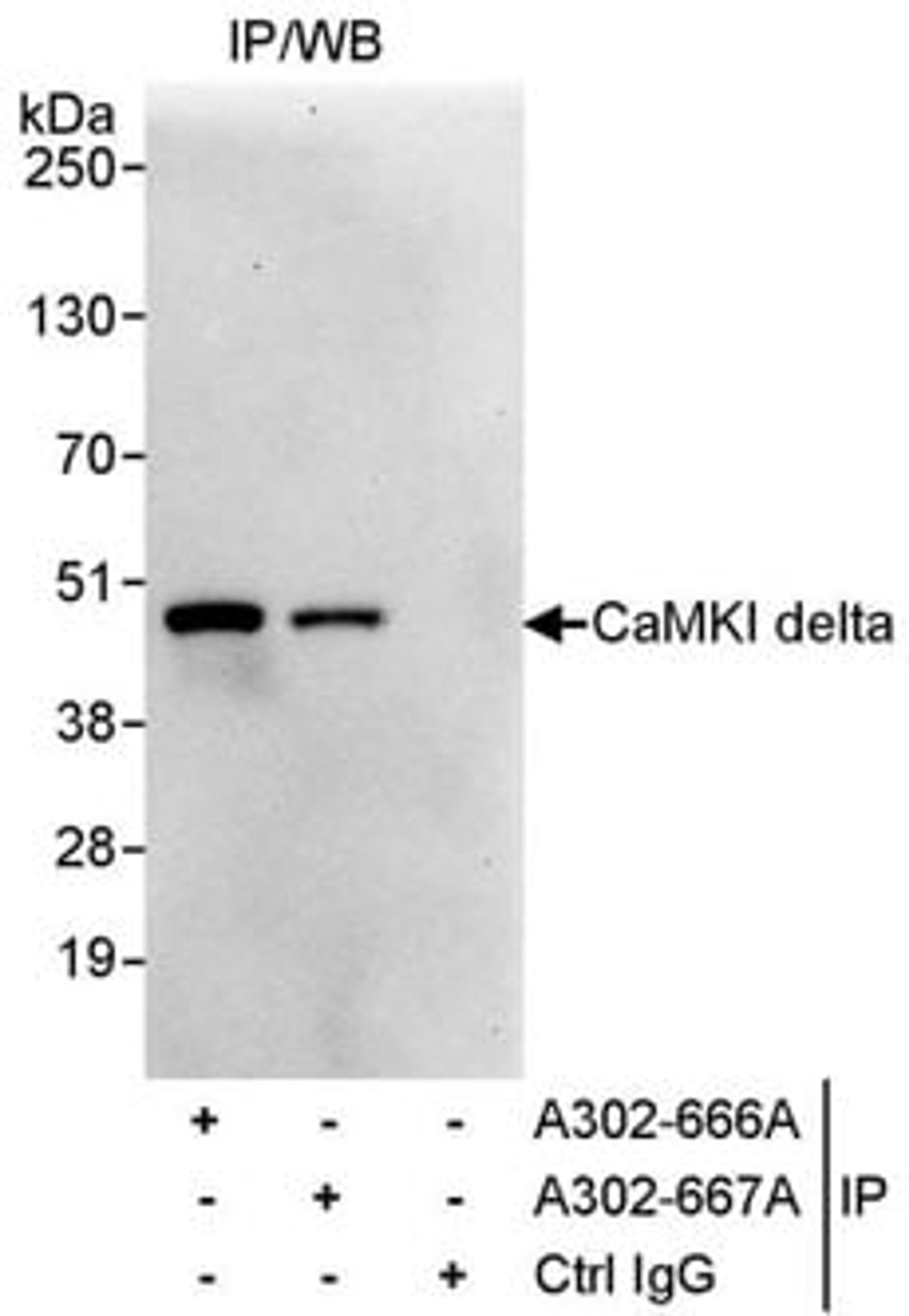 Detection of human CaMKI delta by western blot of immunoprecipitates.