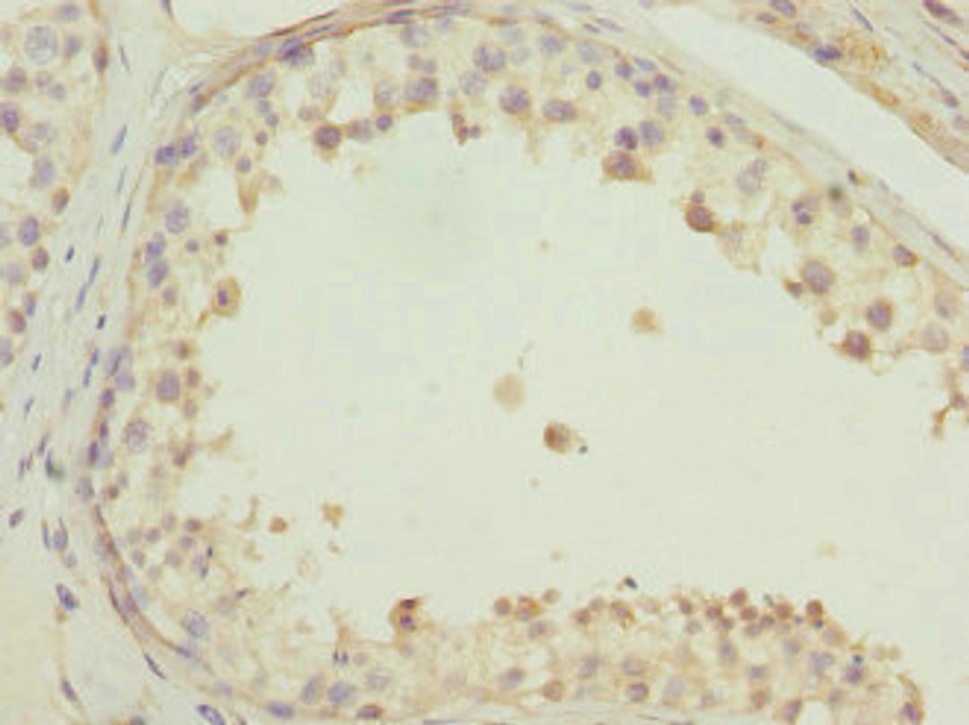Immunohistochemistry of paraffin-embedded human testis tissue using CSB-PA862042ESR2HU at dilution of 1:100