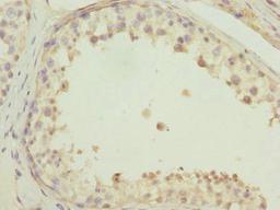 Immunohistochemistry of paraffin-embedded human testis tissue using CSB-PA862042ESR2HU at dilution of 1:100