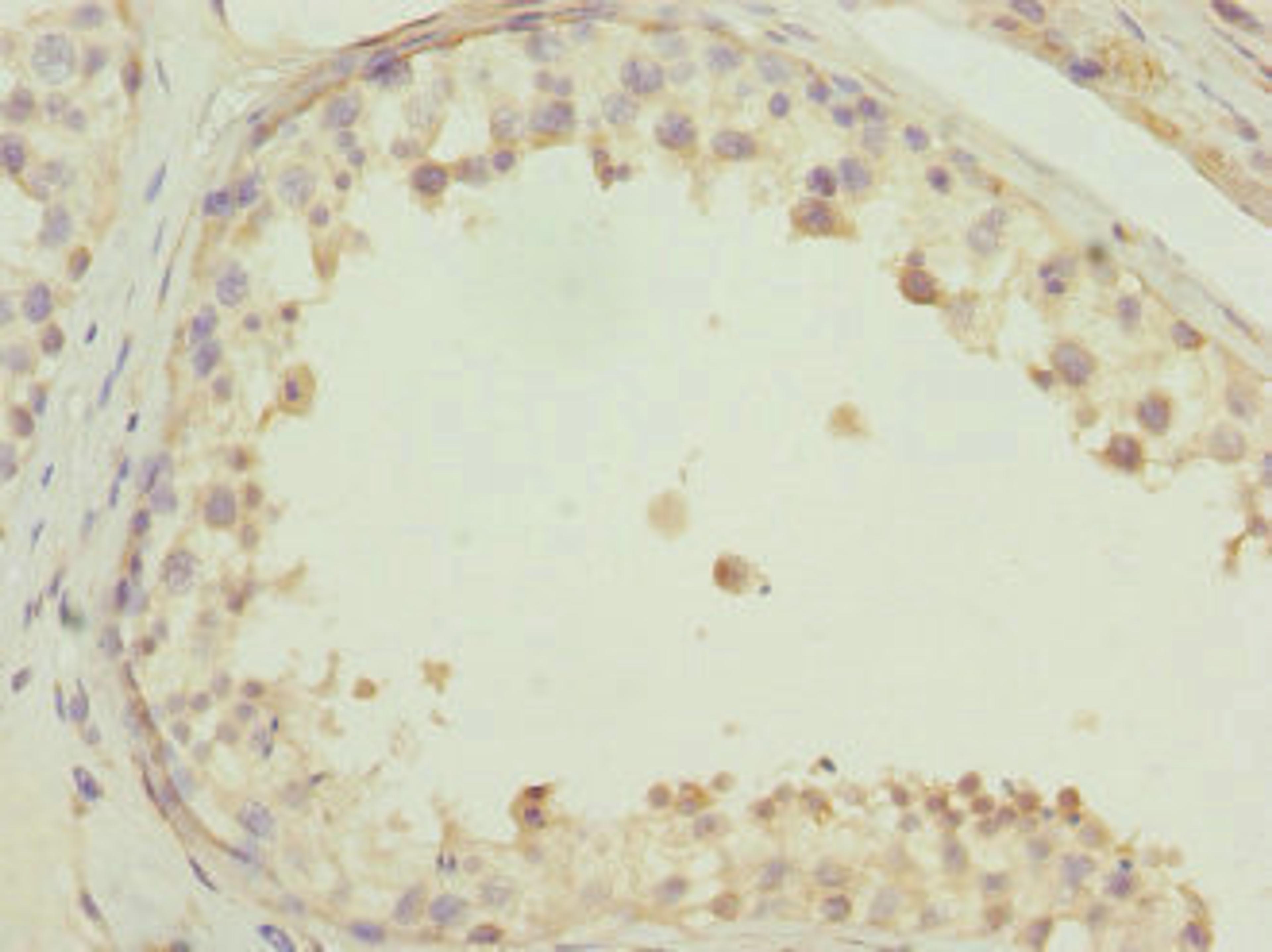 Immunohistochemistry of paraffin-embedded human testis tissue using CSB-PA862042ESR2HU at dilution of 1:100