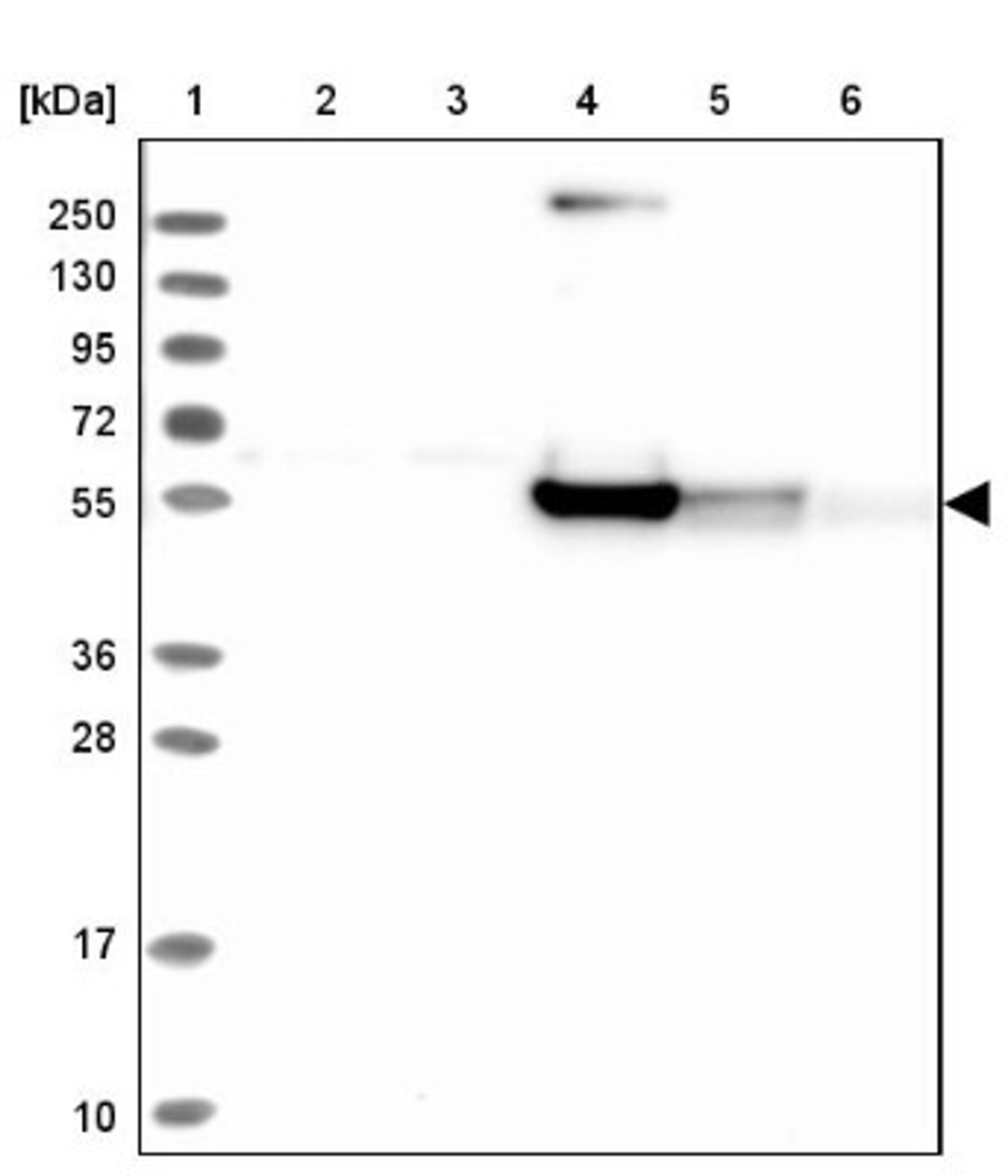 Western Blot: RINL Antibody [NBP1-93741] - Lane 1: Marker [kDa] 250, 130, 95, 72, 55, 36, 28, 17, 10<br/>Lane 2: Human cell line RT-4<br/>Lane 3: Human cell line U-251MG sp<br/>Lane 4: Human plasma (IgG/HSA depleted)<br/>Lane 5: Human liver tissue<br/>Lane 6: Human tonsil tissue