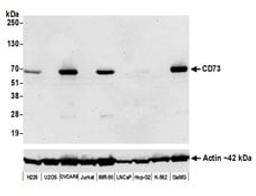 Detection of human CD73 by western blot.