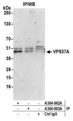 Detection of human VPS37A by western blot of immunoprecipitates.