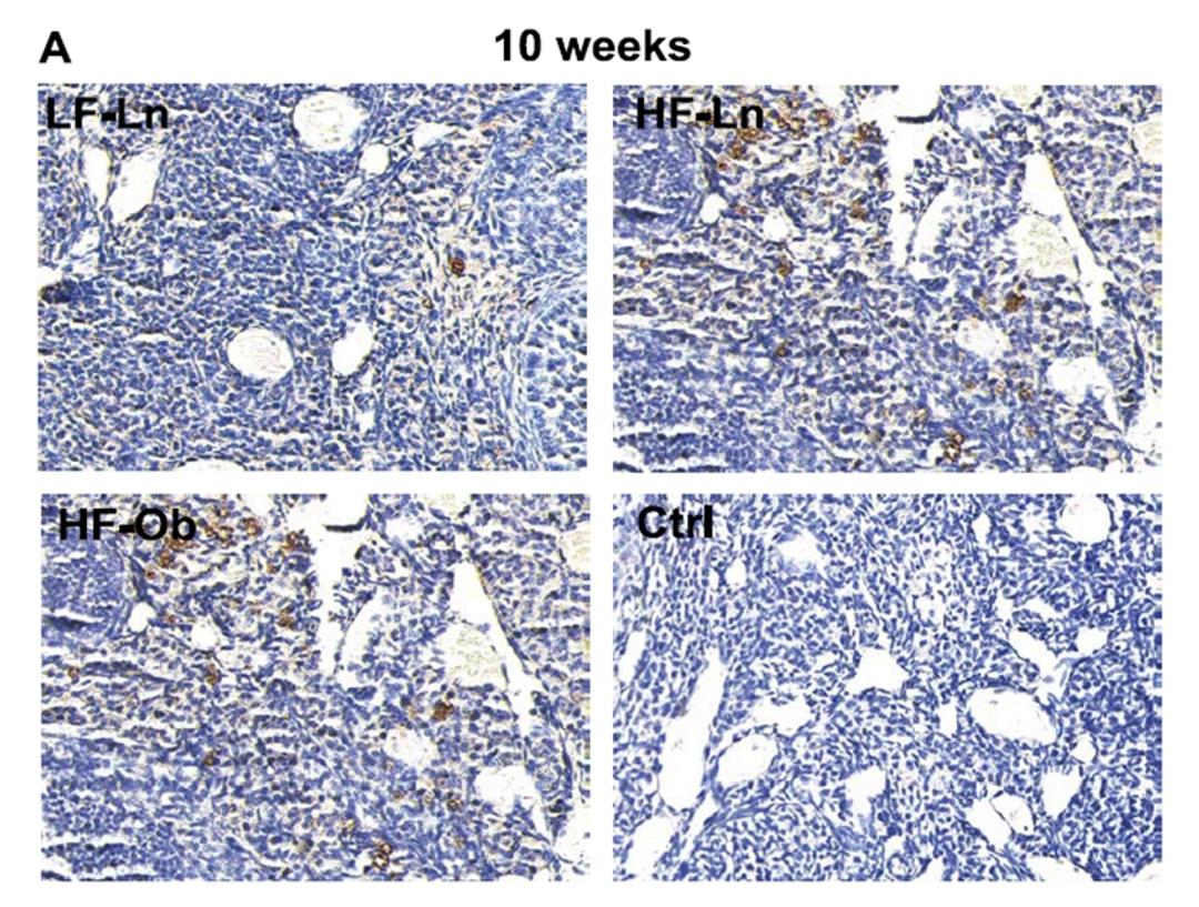 Representative images showing the presence of macrophages in the ovary. Macrophages were identified using marker CD68. Increased expression of macrophage marker CD68 was noted in both the HF-Ln (n¼6) and HF-Ob (n¼6) groups compared to the LF-Ln mice (n¼6)
