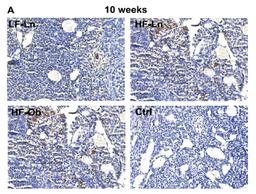 Representative images showing the presence of macrophages in the ovary. Macrophages were identified using marker CD68. Increased expression of macrophage marker CD68 was noted in both the HF-Ln (n¼6) and HF-Ob (n¼6) groups compared to the LF-Ln mice (n¼6)