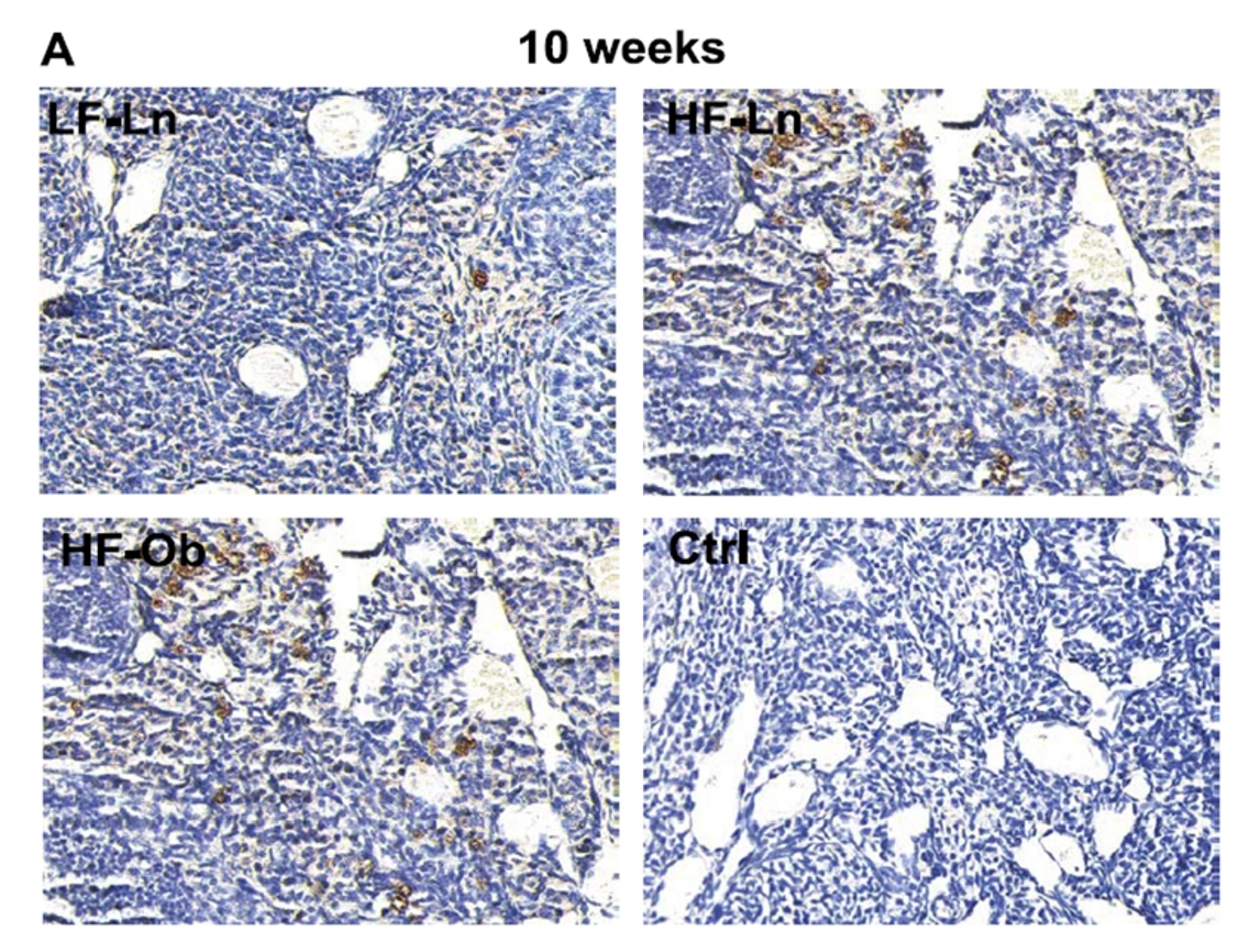 Representative images showing the presence of macrophages in the ovary. Macrophages were identified using marker CD68. Increased expression of macrophage marker CD68 was noted in both the HF-Ln (n¼6) and HF-Ob (n¼6) groups compared to the LF-Ln mice (n¼6)