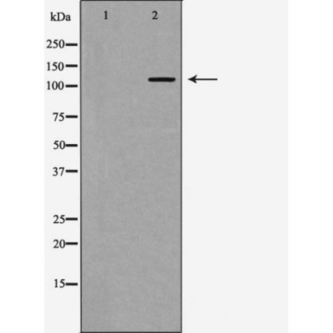 Western blot analysis of mouse liver using PI3 kinase P110Alpha antibody