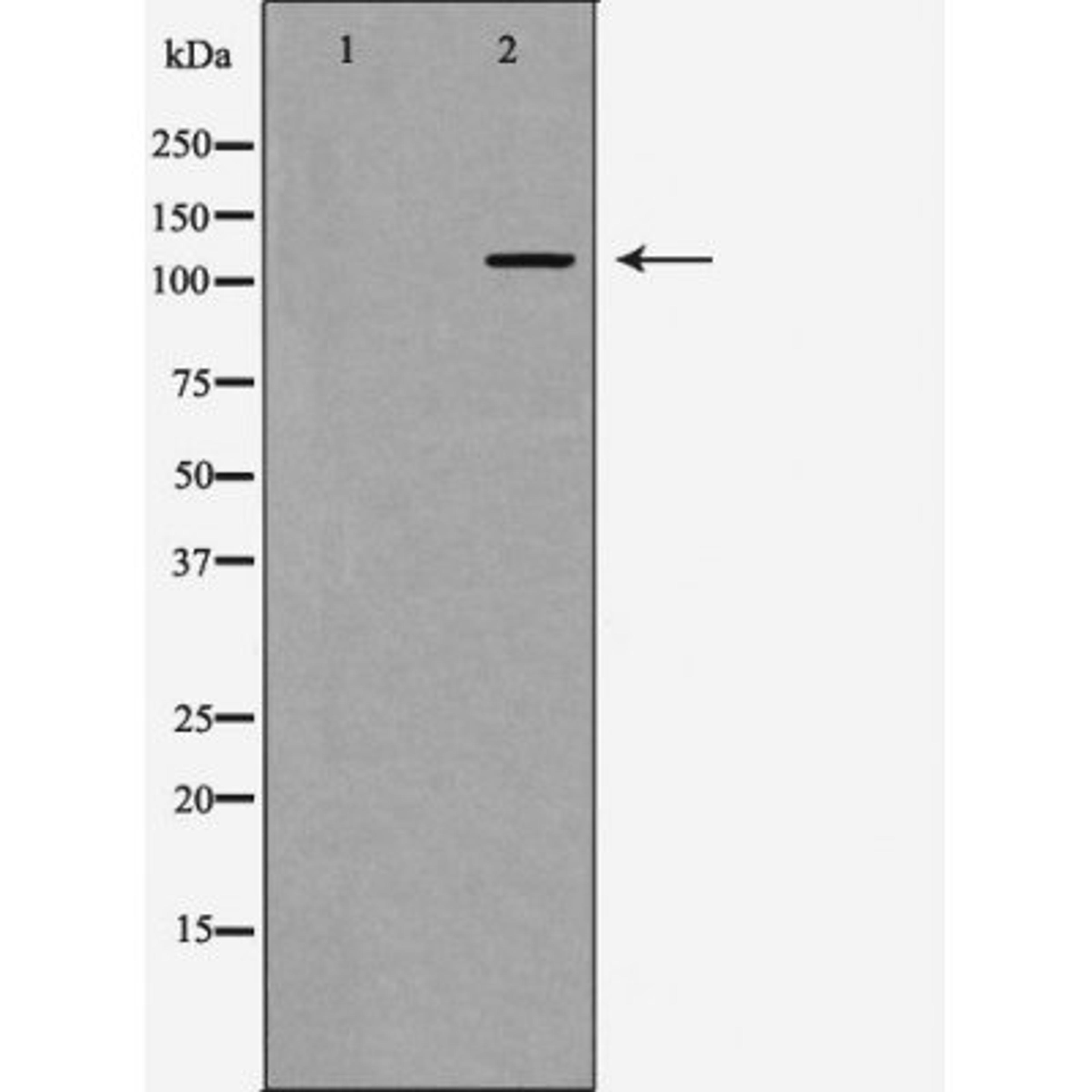 Western blot analysis of mouse liver using PI3 kinase P110Alpha antibody