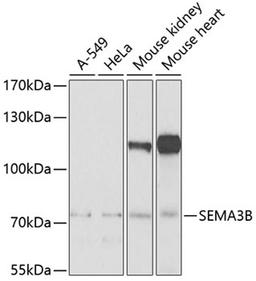 Western blot - SEMA3B Antibody (A7004)