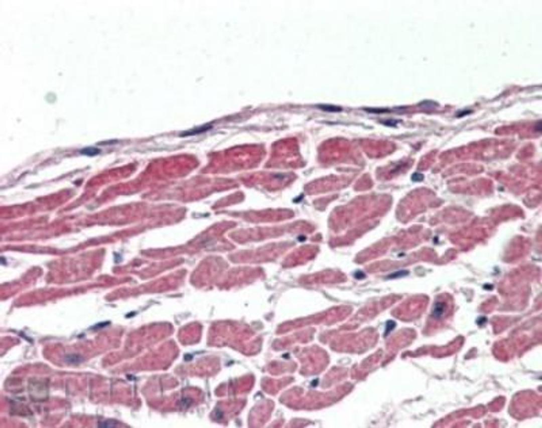 Immunohistochemistry-Paraffin: KCC3/SLC12A6 Antibody [NBP1-06044] - (2.5ug/ml) staining of paraffin embedded Human Heart. Steamed antigen retrieval with citrate buffer pH 6, AP-staining.