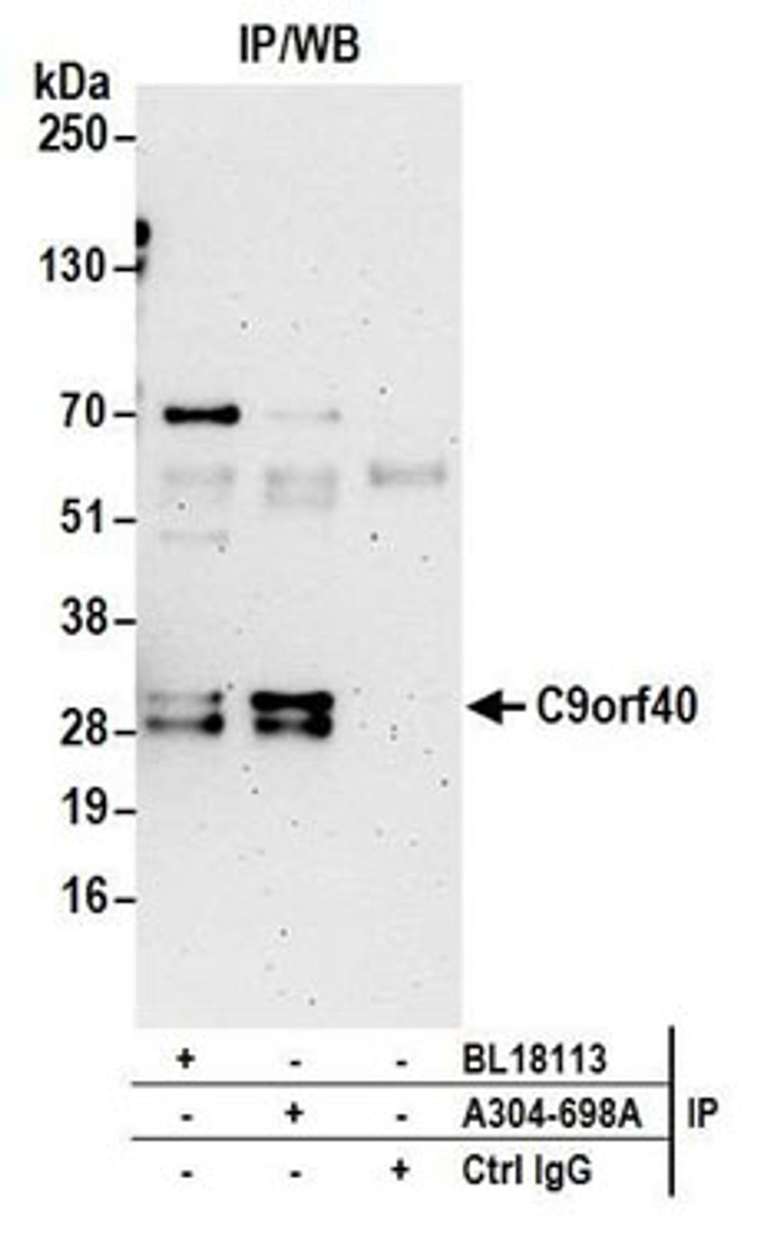 Detection of human C9orf40 by western blot of immunoprecipitates.