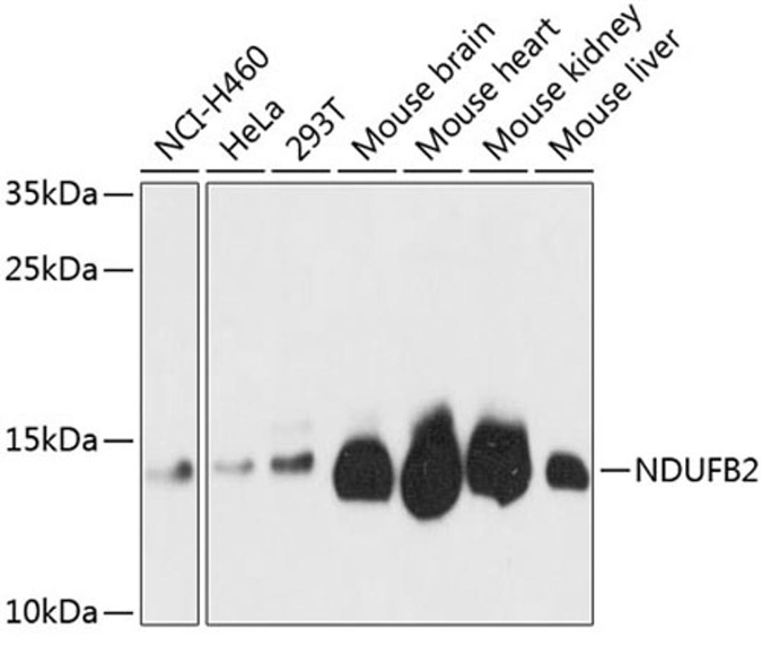 Western blot - NDUFB2 antibody (A3978)