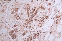 IHC image of CSB-RA029079A0HU diluted at 1:50 and staining in paraffin-embedded human breast cancer performed on a Leica BondTM system. After dewaxing and hydration, antigen retrieval was mediated by high pressure in a citrate buffer (pH 6.0). Section was blocked with 10% normal goat serum 30min at RT. Then primary antibody (1% BSA) was incubated at 4°C overnight. The primary is detected by a Goat anti-rabbit polymer IgG labeled by HRP and visualized using 0.35% DAB.