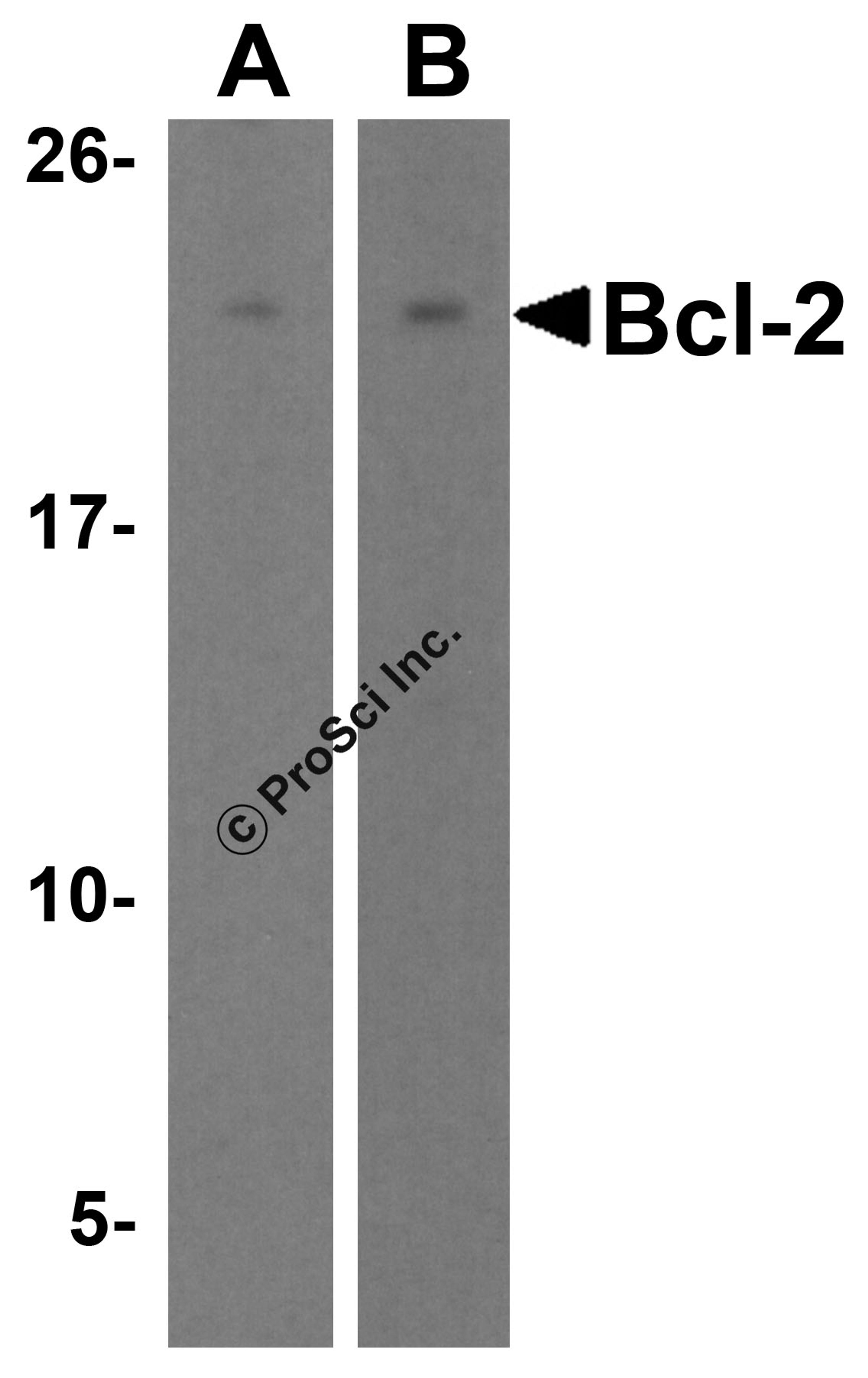 Western blot analysis of Bcl-2 in (A) Daudi and (B) A-20 cell lysates with Bcl-2 antibody at 2 &#956;g/mL.