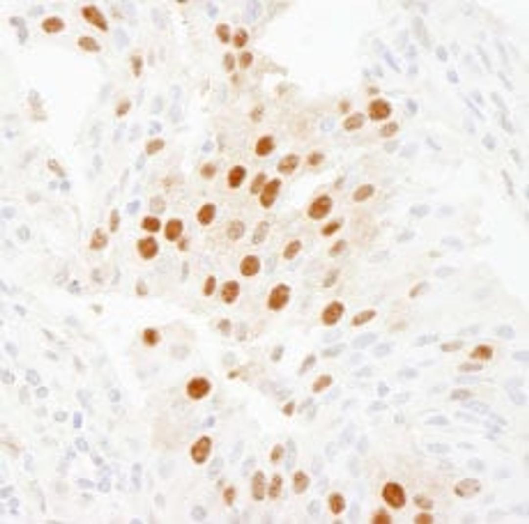 Detection of human WDR77/MEP50 by immunohistochemistry.