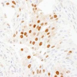 Detection of human WDR77/MEP50 by immunohistochemistry.