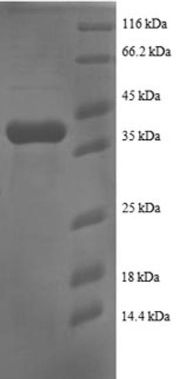 (Tris-Glycine gel) Discontinuous SDS-PAGE (reduced) with 5% enrichment gel and 15% separation gel.