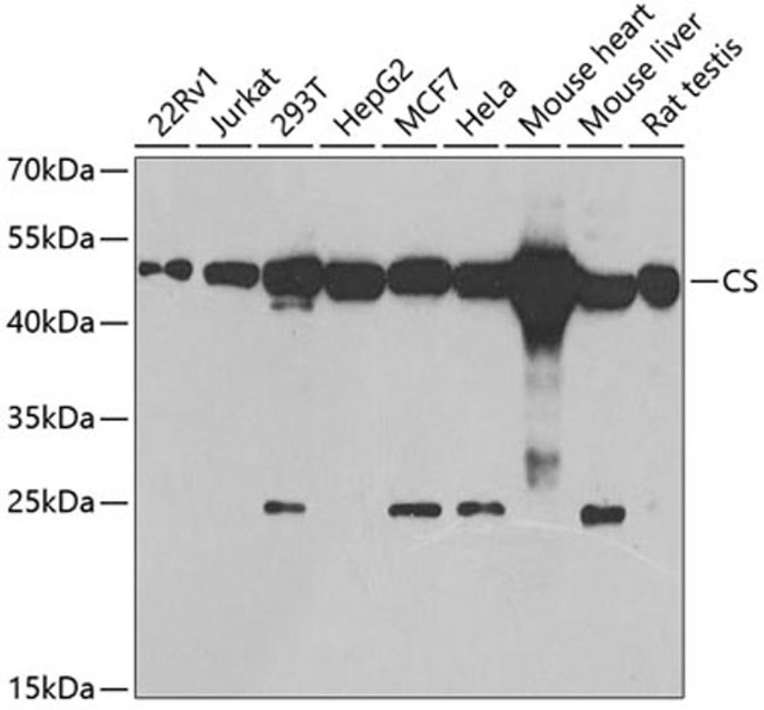 Western blot - CS antibody (A5713)