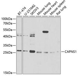 Western blot - CAPNS1 Antibody (A6539)