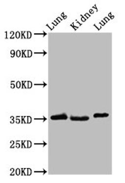 Western Blot. Positive WB detected in: Rat lung tissue, Rat kidney tissue, Mouse lung tissue. All lanes: HOXD1 antibody at 2.4ug/ml. Secondary. Goat polyclonal to rabbit IgG at 1/50000 dilution. Predicted band size: 35 kDa. Observed band size: 35 kDa.