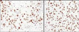 Detection of human and mouse MCM6 by immunohistochemistry.