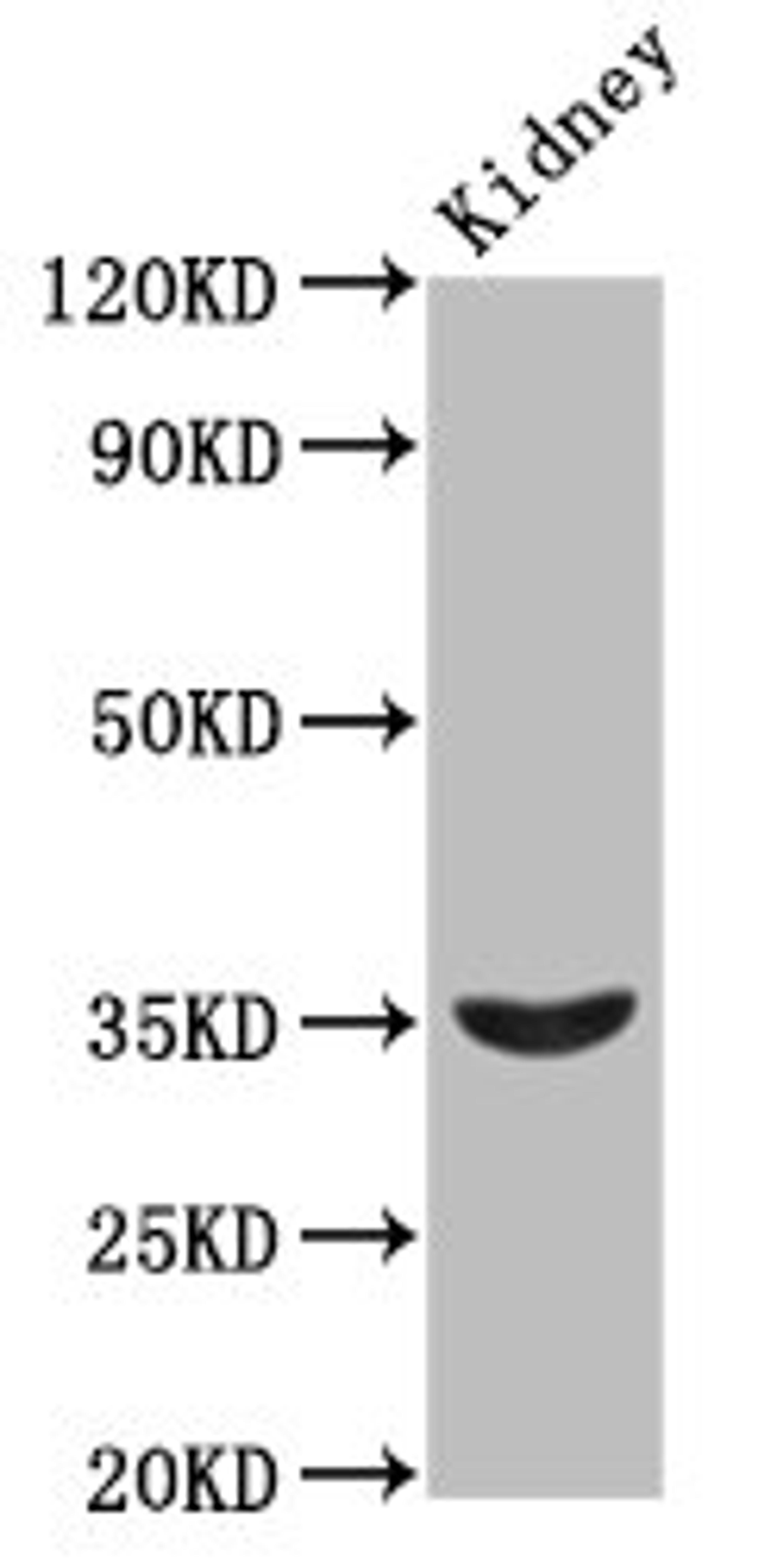 Western Blot. Positive WB detected in: Rat kidney tissue. All lanes: HOXA4 antibody at 2.3ug/ml. Secondary. Goat polyclonal to rabbit IgG at 1/50000 dilution. Predicted band size: 35 kDa. Observed band size: 35 kDa. 