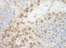 Detection of mouse POGZ by immunohistochemistry.