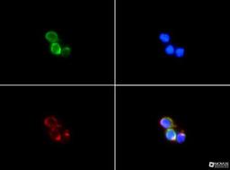 Immunocytochemistry/Immunofluorescence: Cytokeratin 19 Antibody [NBP1-78278] - Tested at 1:25 in MCF7 cells with FITC (green). Nuclei were counterstained with DAPI (blue).