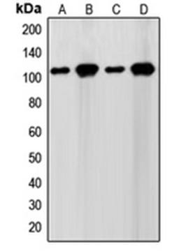 Western blot analysis of WI38 (Lane 1), HeLa (Lane 2), NIH3T3 (Lane 3), Jurkat (Lane 4) whole cell lysates using SENP7 antibody