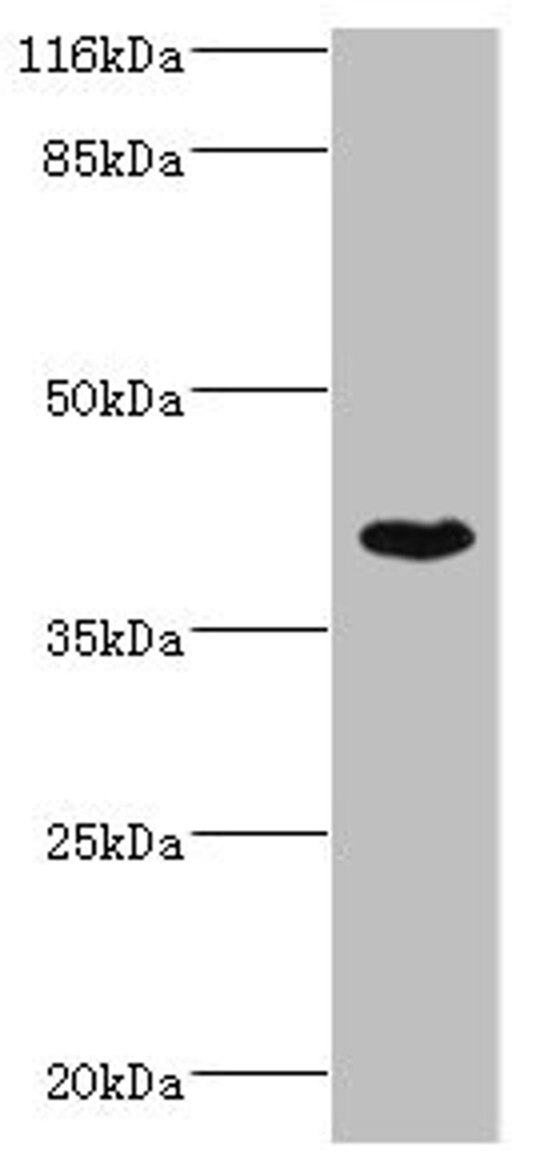 Western blot. All lanes: SETD7 antibody at 4µg/ml + MCF-7 whole cell lysate. Secondary. Goat polyclonal to rabbit IgG at 1/10000 dilution. Predicted band size: 41 kDa. Observed band size: 41 kDa