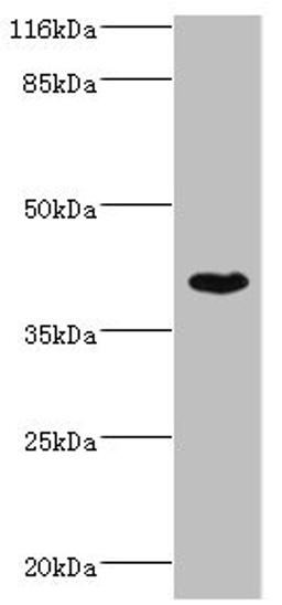 Western blot. All lanes: SETD7 antibody at 4µg/ml + MCF-7 whole cell lysate. Secondary. Goat polyclonal to rabbit IgG at 1/10000 dilution. Predicted band size: 41 kDa. Observed band size: 41 kDa