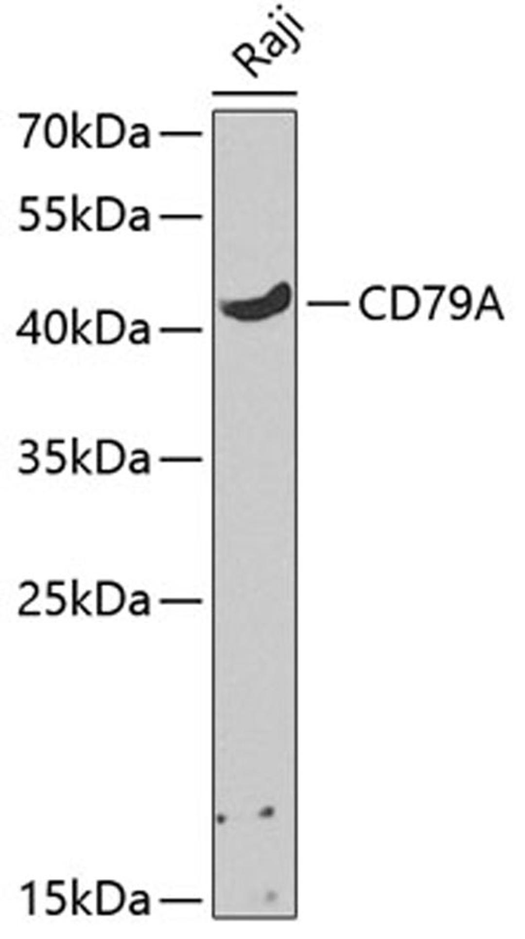 Western blot - CD79A antibody (A0331)