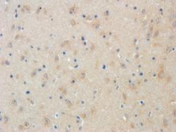 Immunohistochemical staining of mouse brain tissue using LRIG1 antibody (2.5 ug/ml)