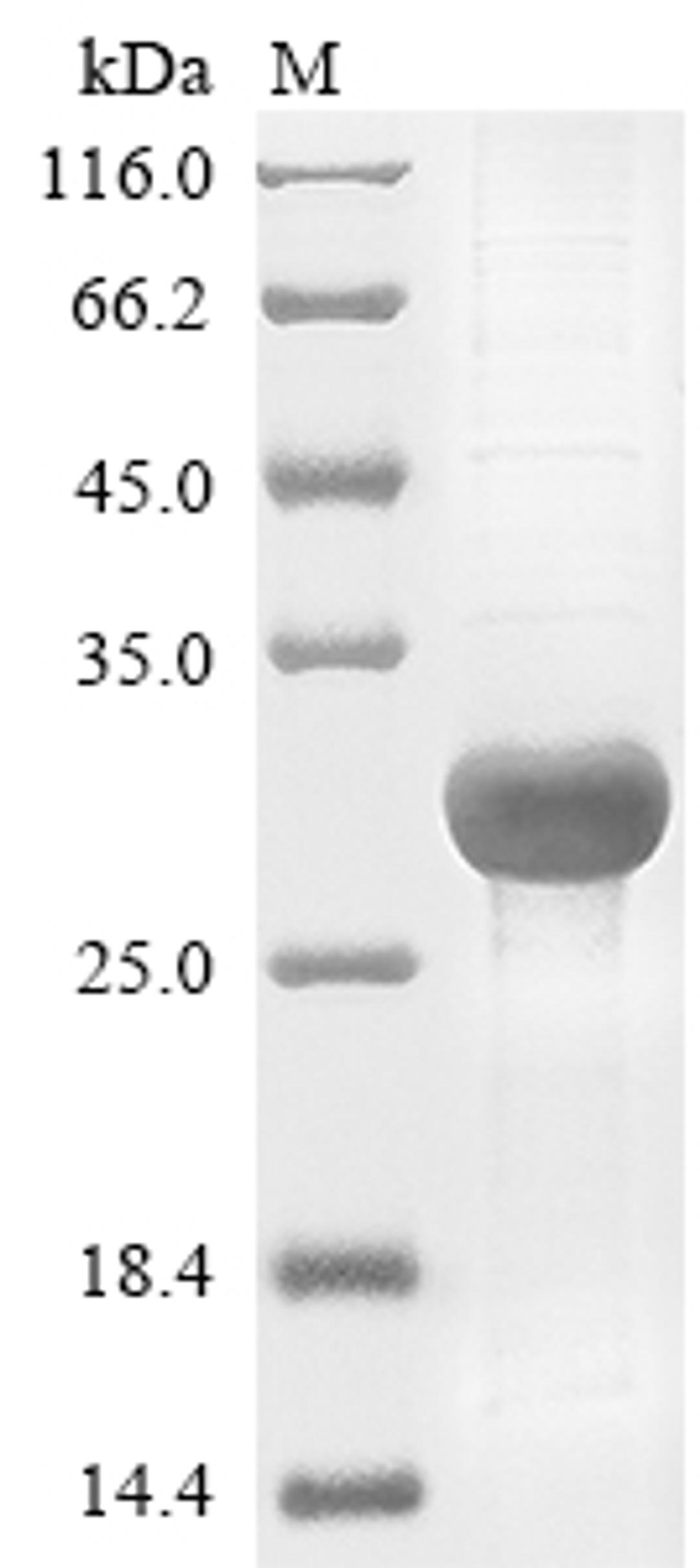 (Tris-Glycine gel) Discontinuous SDS-PAGE (reduced) with 5% enrichment gel and 15% separation gel.