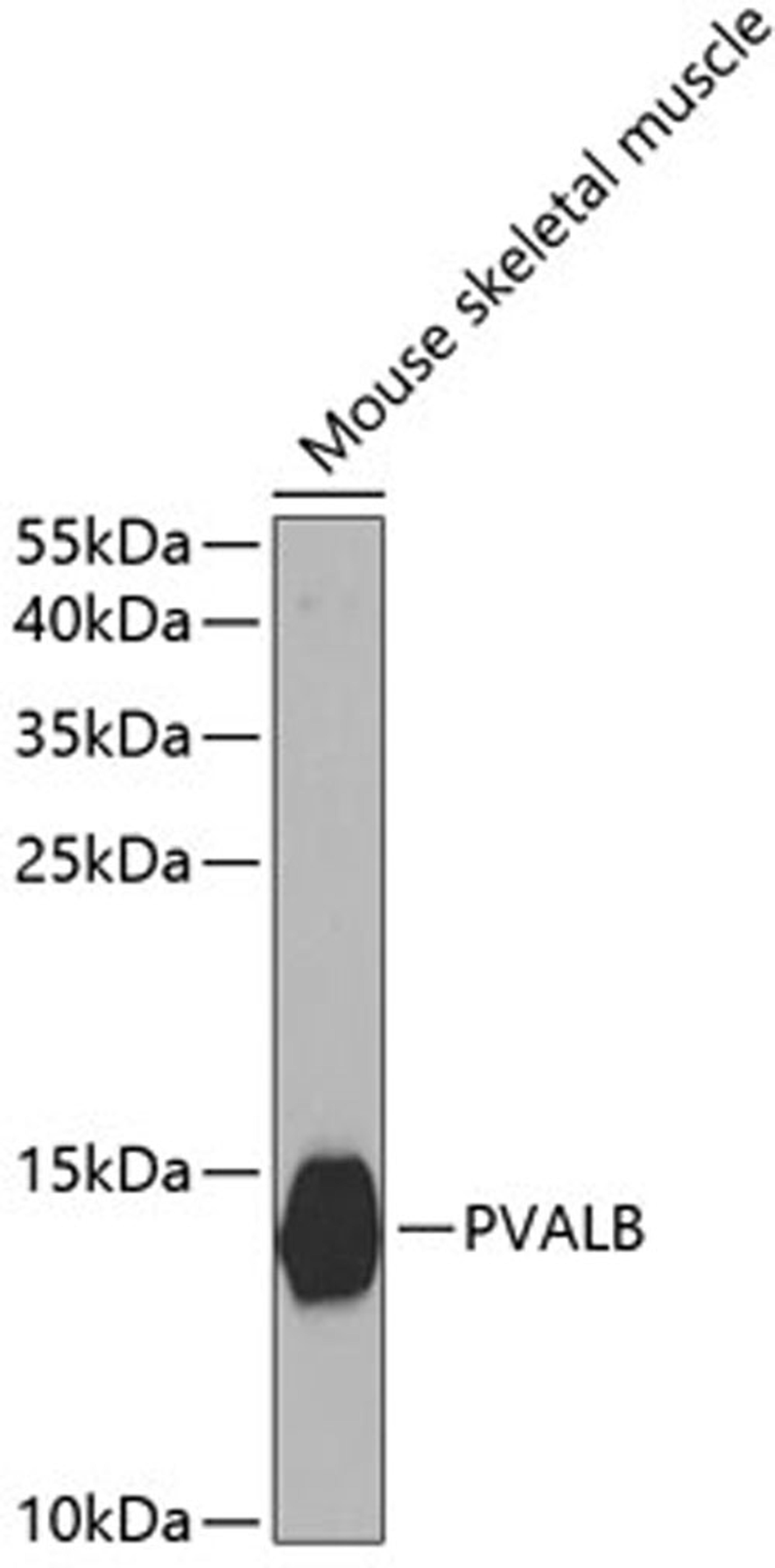 Western blot - PVALB antibody (A2791)