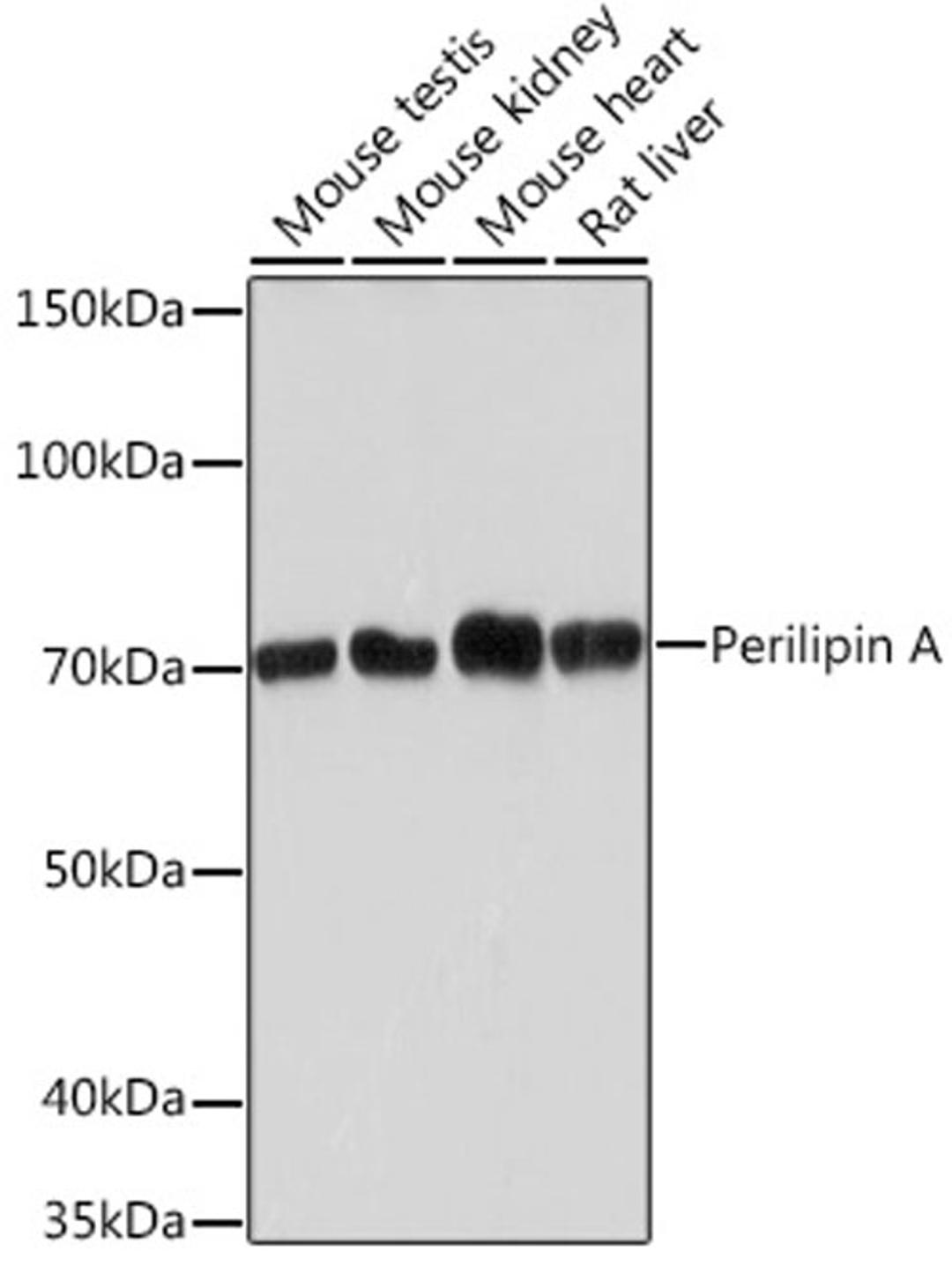 Western blot - Perilipin A Rabbit mAb (A4758)