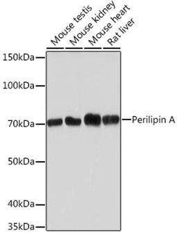 Western blot - Perilipin A Rabbit mAb (A4758)